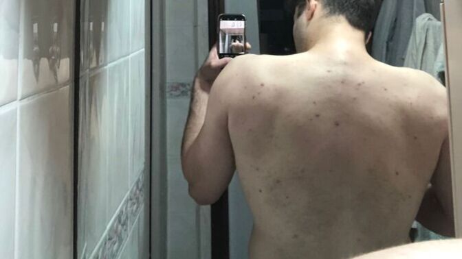 Ağırlık kaldırınca sırtım neden böyle oluyor?