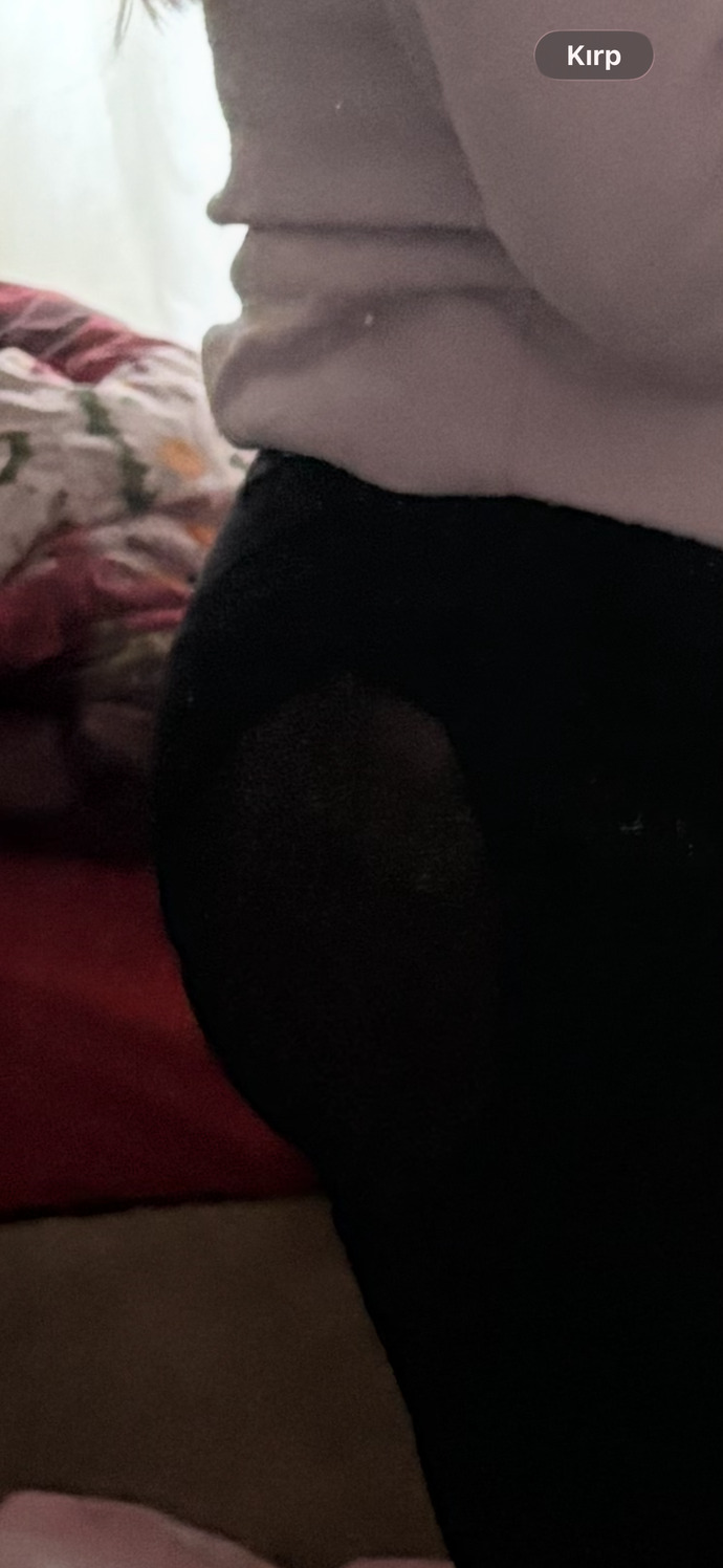 Popom çok mu şekilsiz, spora başlasam ne kadar sürede nasıl bir değişim olur?