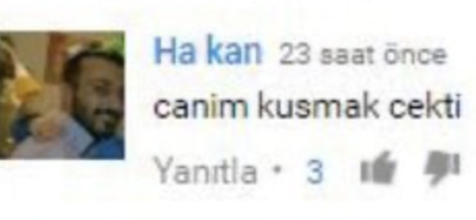 Ayaklara oje yakışıyor mu?