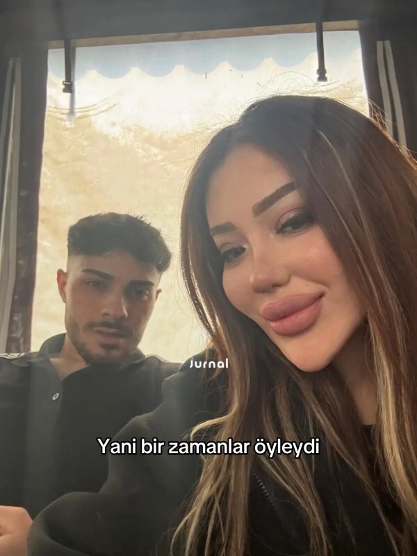Erkekler bu tarz çene ve yanak yapısını seviyor musunuz?
