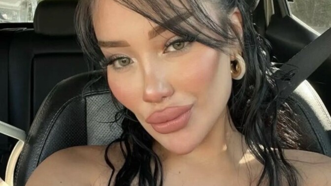 Erkekler bu tarz çene ve yanak yapısını seviyor musunuz?