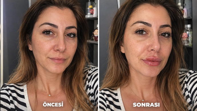 Nasil olmus sizce ben begendim?