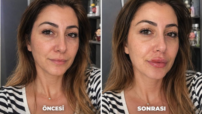 Nasil olmus sizce ben begendim?