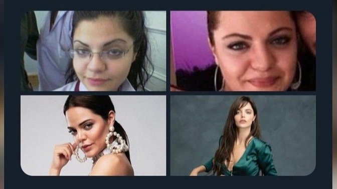 Estetik iyi ki varsın diyor musunuz?