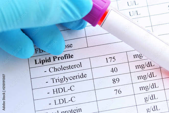 Kan yağlarınız (HDL, LDL, Trigliserid, Total Kolestrol) yüksek mi?