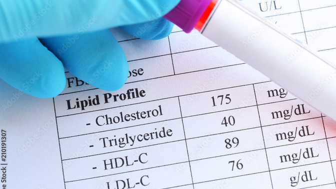 Kan yağlarınız (HDL, LDL, Trigliserid, Total Kolestrol) yüksek mi?