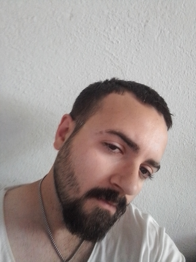 Yüzüm cok mu şiskin duruyor bide 174 boyunda biri kac kilo olursa ideal kiloda olur?