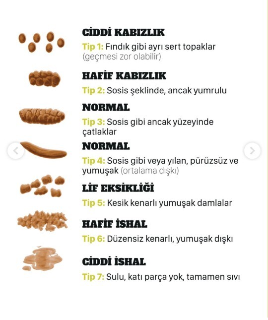 Ne çeşit kabızlık çekiyorsunuz?