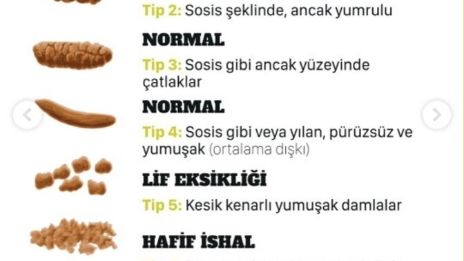 Ne çeşit kabızlık çekiyorsunuz?