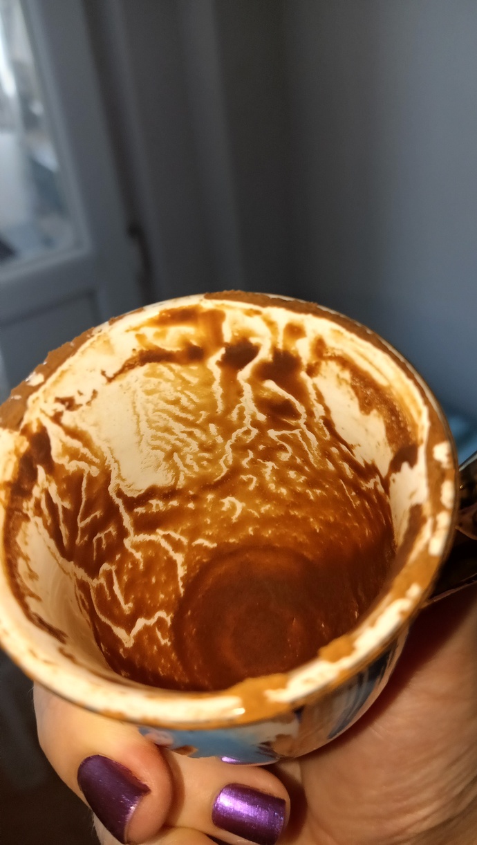 Falllima bakar misinizzz?