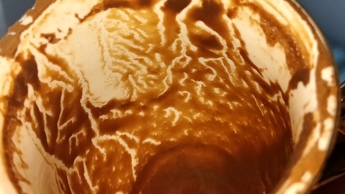 Falllima bakar misinizzz?