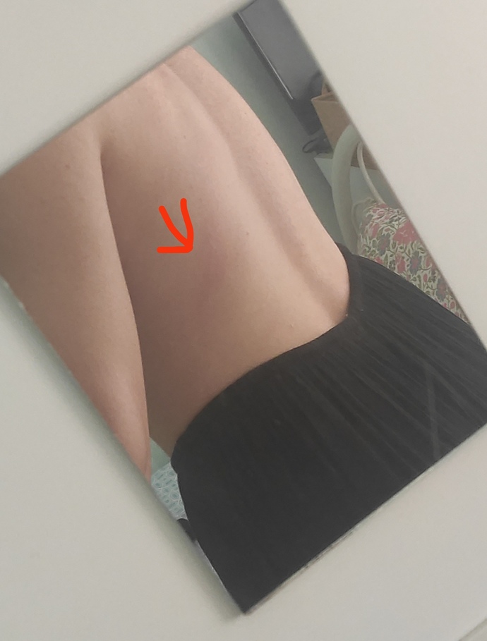 Sabah yataktan kalktığımda sırtımda hep kırmızı yaralar oluyor ve baya acıtıyor?