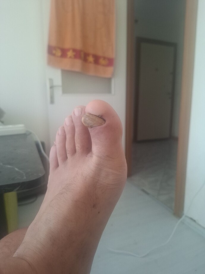 Sevgilinizin ayak tırnaklarını keser miydiniz?