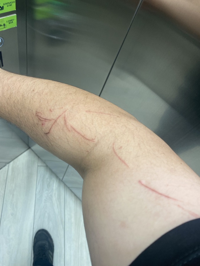 Sizi hiç kedi tırmaladı mı?