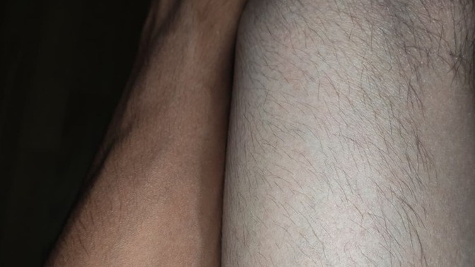 Güneşte çok yanıp kararan kol ve bacak cildi nasıl açılır, ne yapmalıyım?