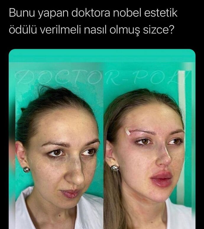 Bu estetiğe 10 üzerinden kaç puan verirsiniz?