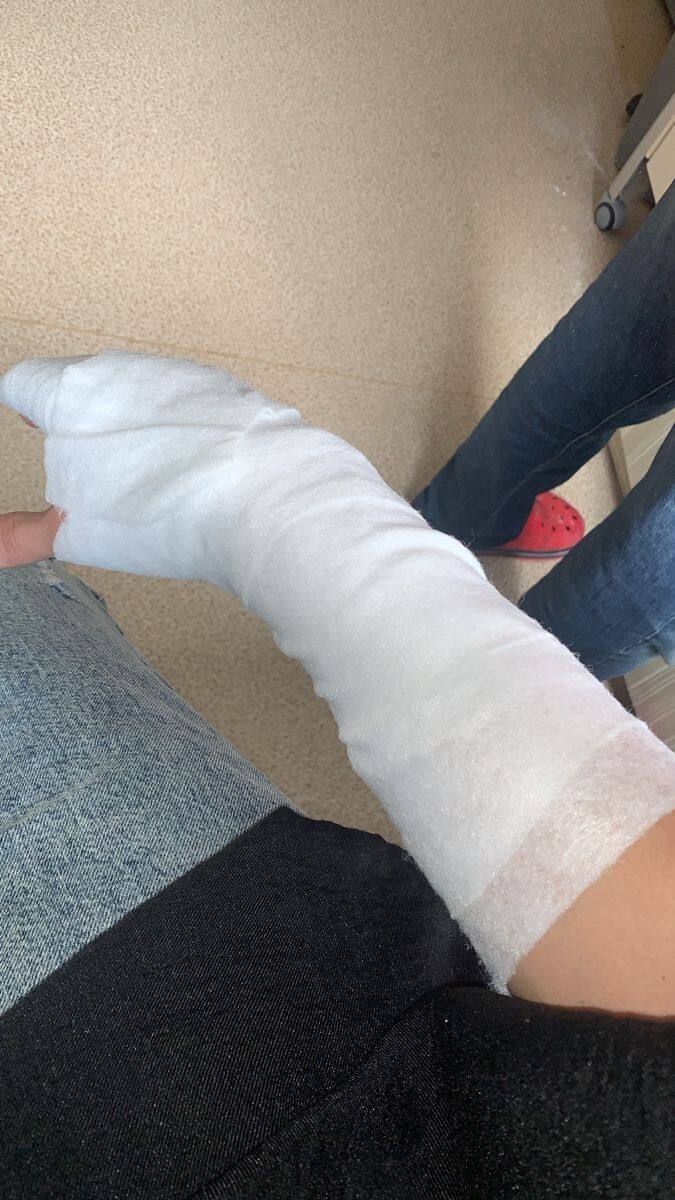 Kırık çıkık yaşadınız mı?