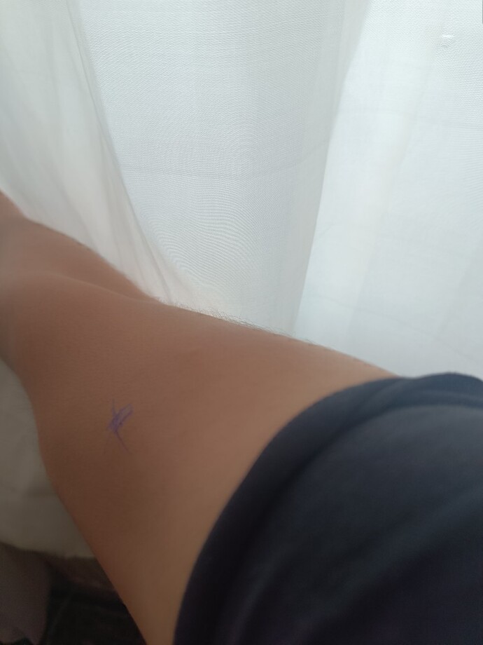 Arkadaşlar aranızda tıptan anlayan varsa biri bana yardımcı olabilirmi?