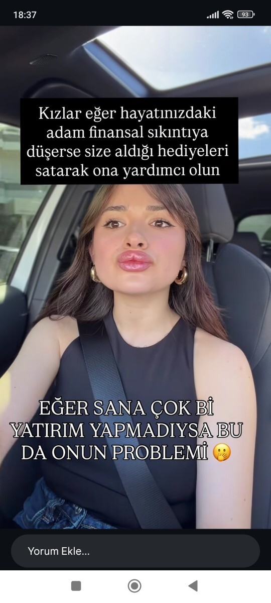 Bu dudaklar normal mi sizce?