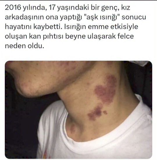 Günümüz ilişkileri öldürmüyor ama süründürüyor mu?