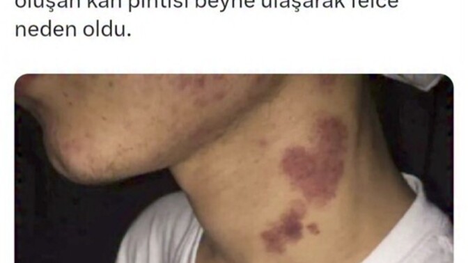Günümüz ilişkileri öldürmüyor ama süründürüyor mu?
