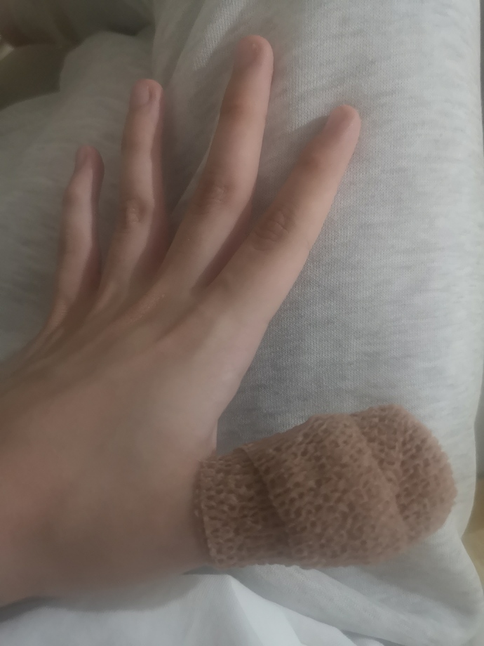 Parmağımı kestim bi geçmiş olsun der misiniz😭 ?