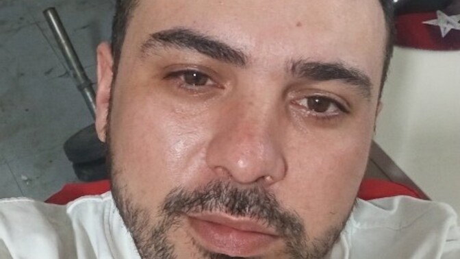 Saç ektirdim nasıl olmuş sizce, tipimle beraber 10 üzerinden kaç verirsiniz?