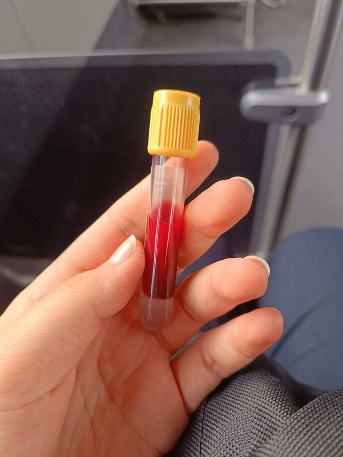 Lityum değerinize baktırdınız mı?