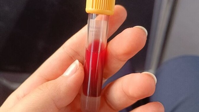 Lityum değerinize baktırdınız mı?
