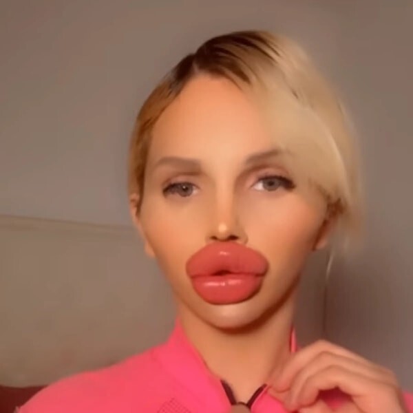 Dudaklarımda estetik olduğu çok belli olmuyor dimi?