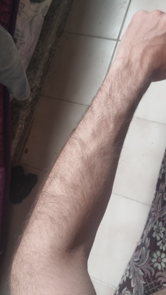Kol kıllarım çok mu?