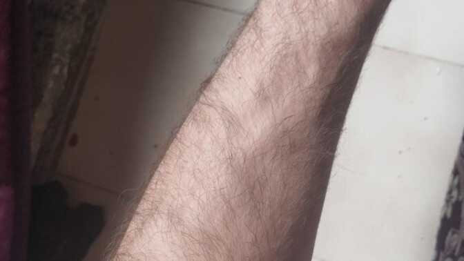 Kol kıllarım çok mu?