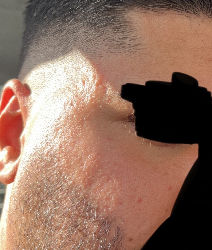 Kızlar, Sizce bu cilt düzelir mi?