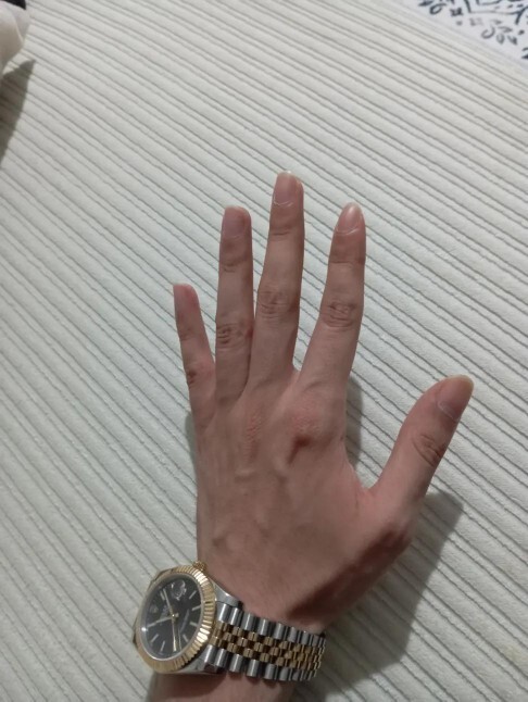Elim nasıl gözüküyor?
