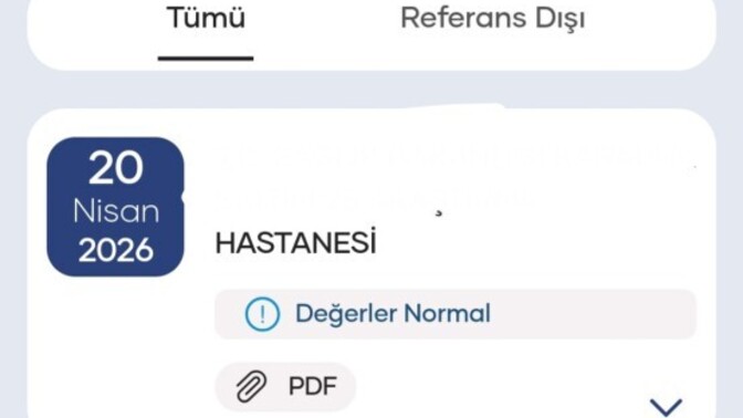 Geç fark edip pişman olduğun en son şey ne?