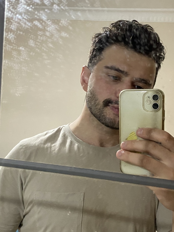 Saç gitti nasıl oldi?