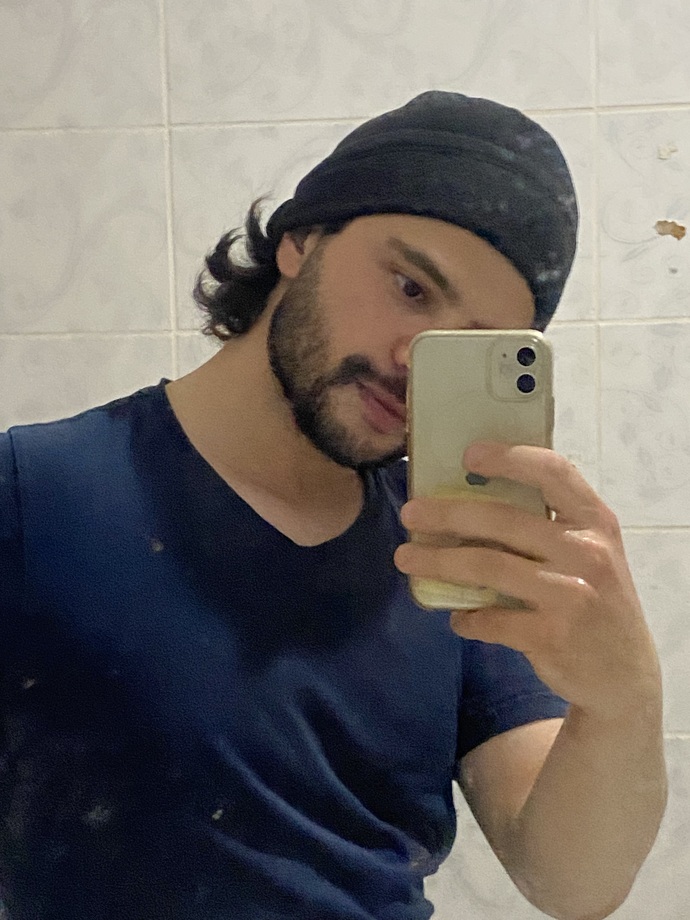 Saç gitti nasıl oldi?
