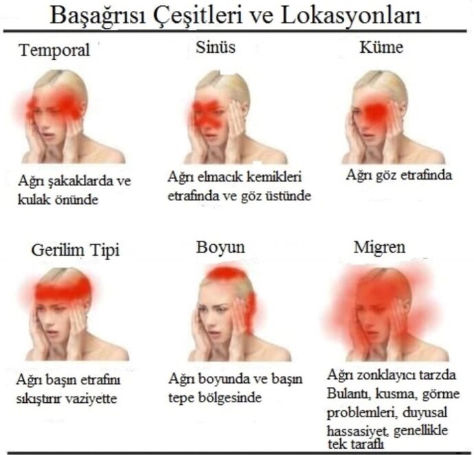 İki gündür geçmeyen bir baş ağrım var, ilk kez arveles bile fayda etmedi, acil çare bulabilir misiniz?