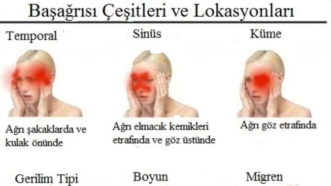 İki gündür geçmeyen bir baş ağrım var, ilk kez arveles bile fayda etmedi, acil çare bulabilir misiniz?