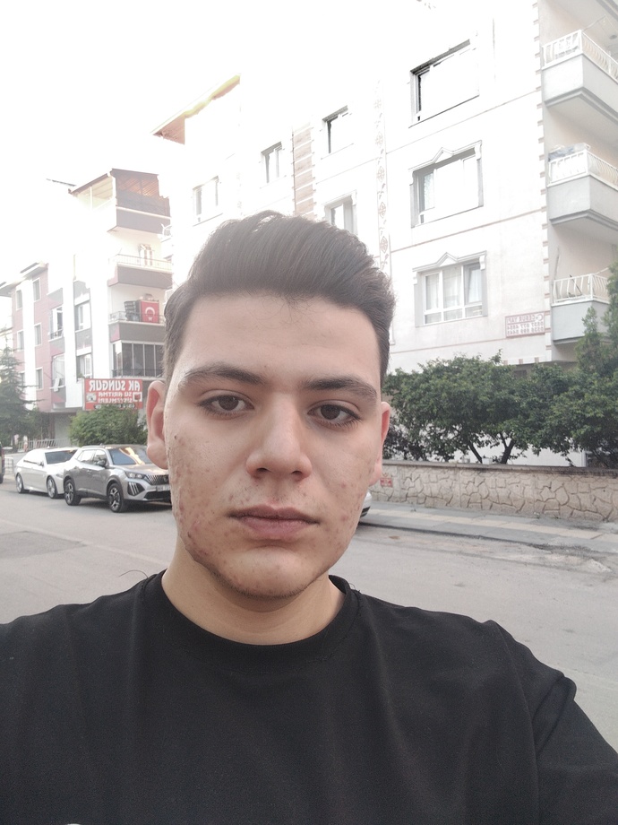 Sürekli reddediliyorum, sizce gerçekten çirkin miyim yoksa sorun başka bir şey mi?