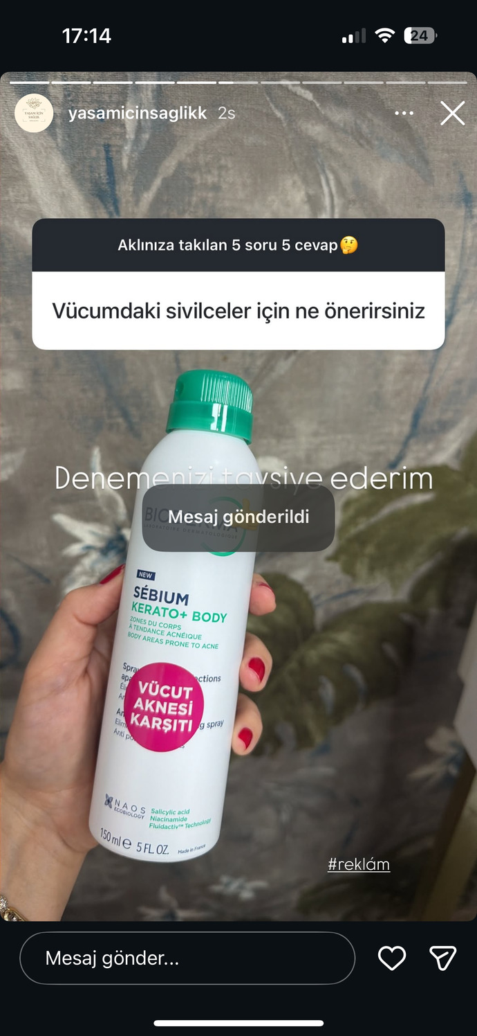Omuzlarımda kollarımda sırtımda geçmeyen sivilce ve lekeler var doktor krem verip bakmadı bile geçiştirdi ağlayacağım?
