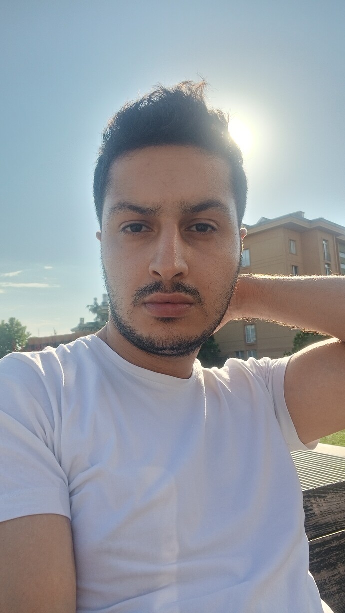 Yüzüm çok mu çirkin?