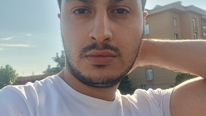 Yüzüm çok mu çirkin?