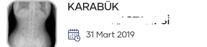 Bel eğriliğiniz var mı?