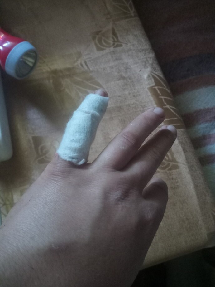 Hiç kaza geçirdiniz mi?