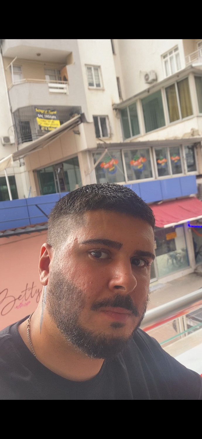 Kızlar, Cildimdeki sivilce izlerinden dolayı özgüven kaybı yaşıyorum gerçekten kötü mü duruyor yoksa ben mi büyütüyorum?