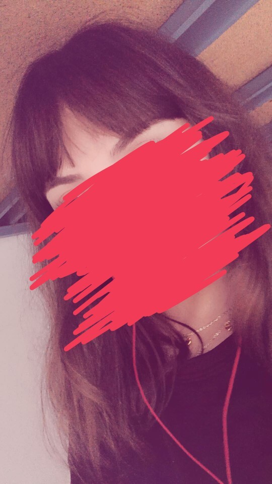 Alnım geniş ve kahkül sivilce yapıyor, alnı geniş gösteren saç modeli yerine ne kullanabilirim?