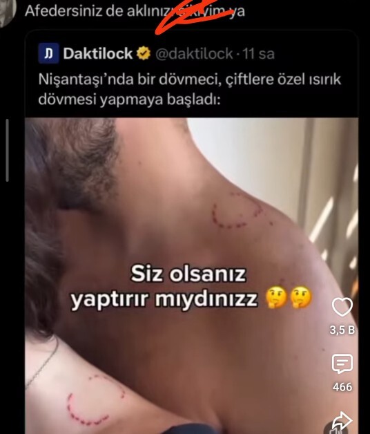 Eşinizin ısırık izini dövme yapar mıydınız 😂?