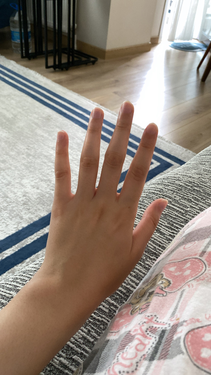 Tırnaklarıma protez yaptırmalı mıyım?