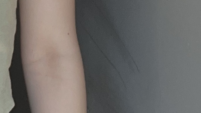 Beyaz tenli miyim, ten rengim hangi tona giriyor sizce?